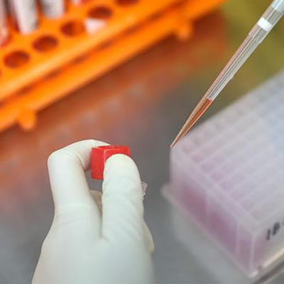 Doença infecciosa PCR em tempo real Monkeypox Test Kit MPXV CE registrado 1 teste/caixa