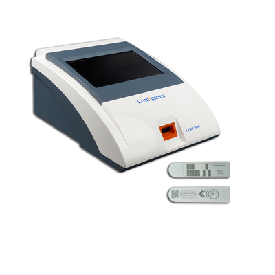 Kit de Detecção Quantitativa NGAL TRFIA Detecção de Lesão Renal Aguda